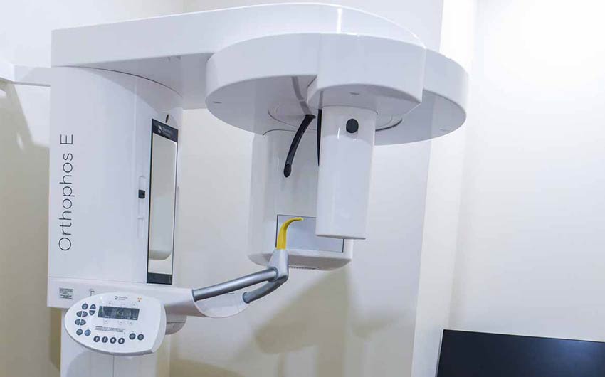 Digital X-Rays | Dental on 8th | SE Calgary | General and Family Dentist